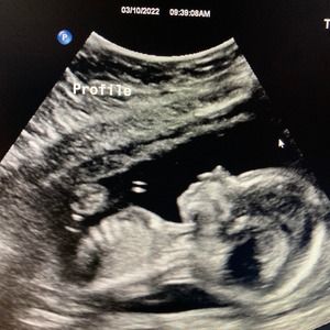 Meet your Posher, Axle